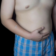 One in 10 children in first year of primary school in England is obese